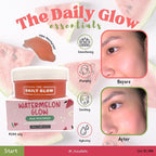 The Daily Glow - Watermelon Glow Aqua Moisturizer 100ml - My Care Kits