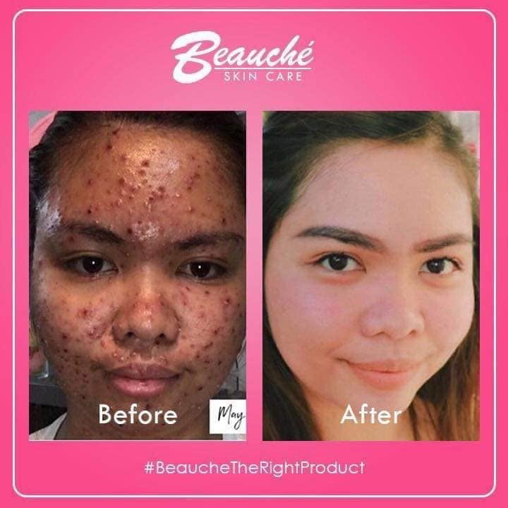 Beauche Beauty Set (Dark pink) - My Care Kits