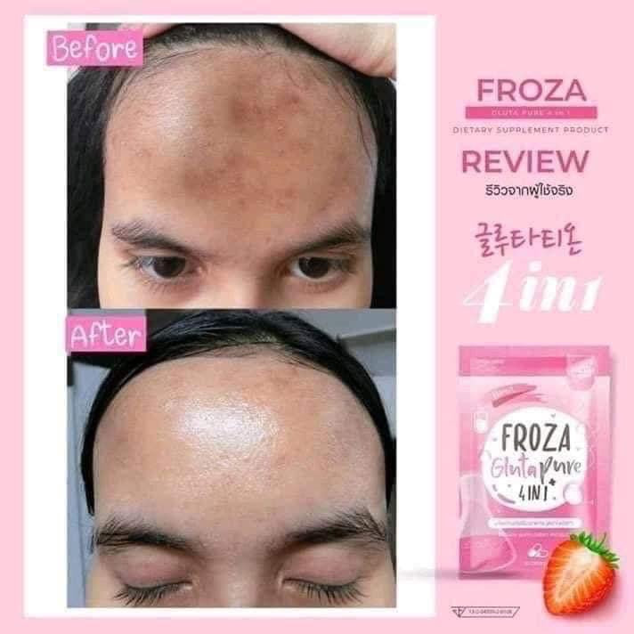 Froza Gluta Pure 4 in 1 - My Care Kits