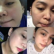 Brilliant Skin Essentials Tomato Set - My Care Kits