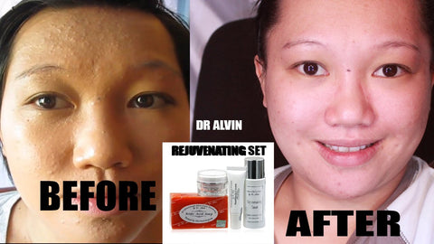 Dr. Alvin Rejuvenating Set Professional Skin Care No. 5