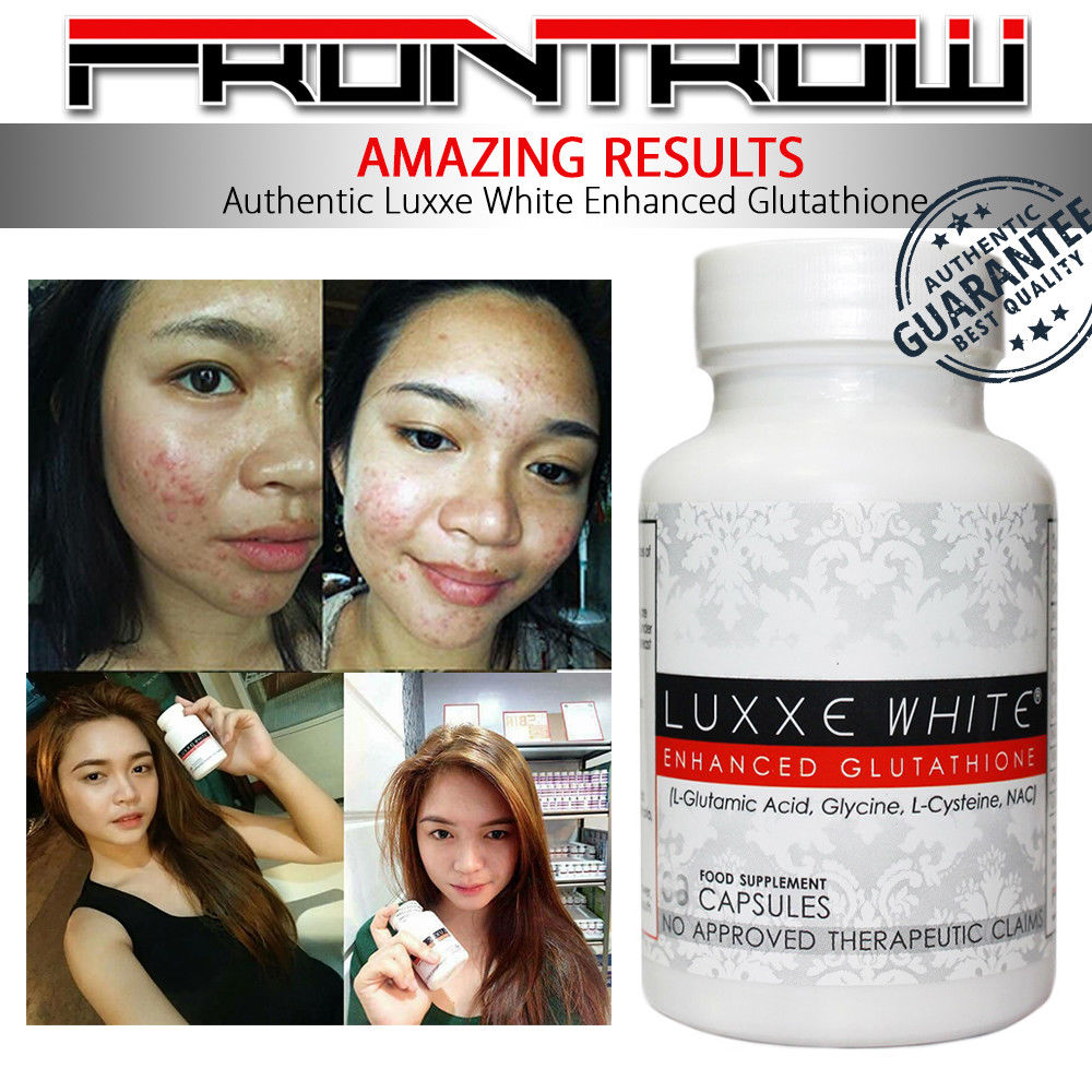 Luxxe White - Enhanced Glutathione 60 Capsules (775mg) - My Care Kits