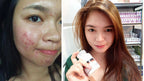 Luxxe White - Enhanced Glutathione 60 Capsules (775mg) - My Care Kits
